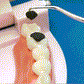 🏆German precision engineering! 0.1mm ultra-fine tip for precise flossing✨