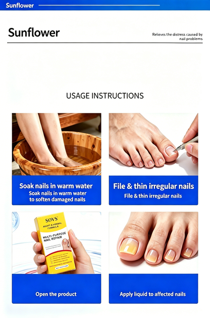 Nail Fungus Treatment Solution