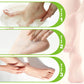 Moisturizing Foot Cream for Calluses